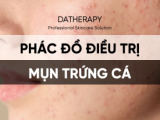 PHÁC ĐỒ ĐIỀU TRỊ MỤN