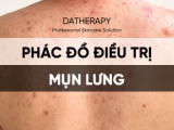 PHÁC ĐỒ ĐIỀU TRỊ MỤN LƯNG