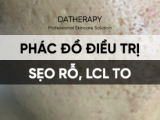 PHÁC ĐỒ ĐIỀU TRỊ SẸO RỖ - LỖ CHÂN LÔNG TO