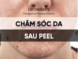 CHĂM SÓC DA SAU PEEL