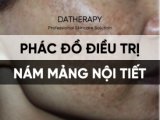 PHÁC ĐỒ ĐIỀU TRỊ NÁM NỘI TIẾT